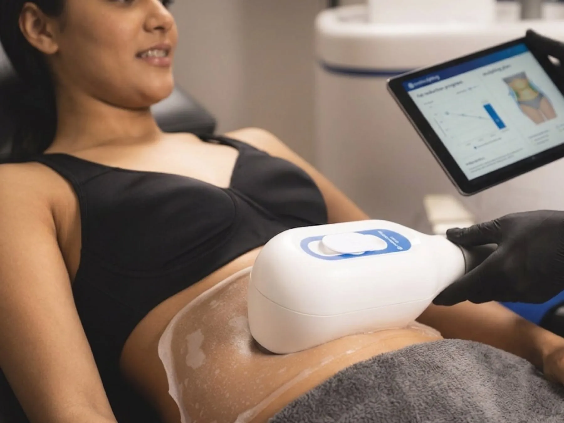 CoolSculpting at 360° Aesthetics Tijuana
