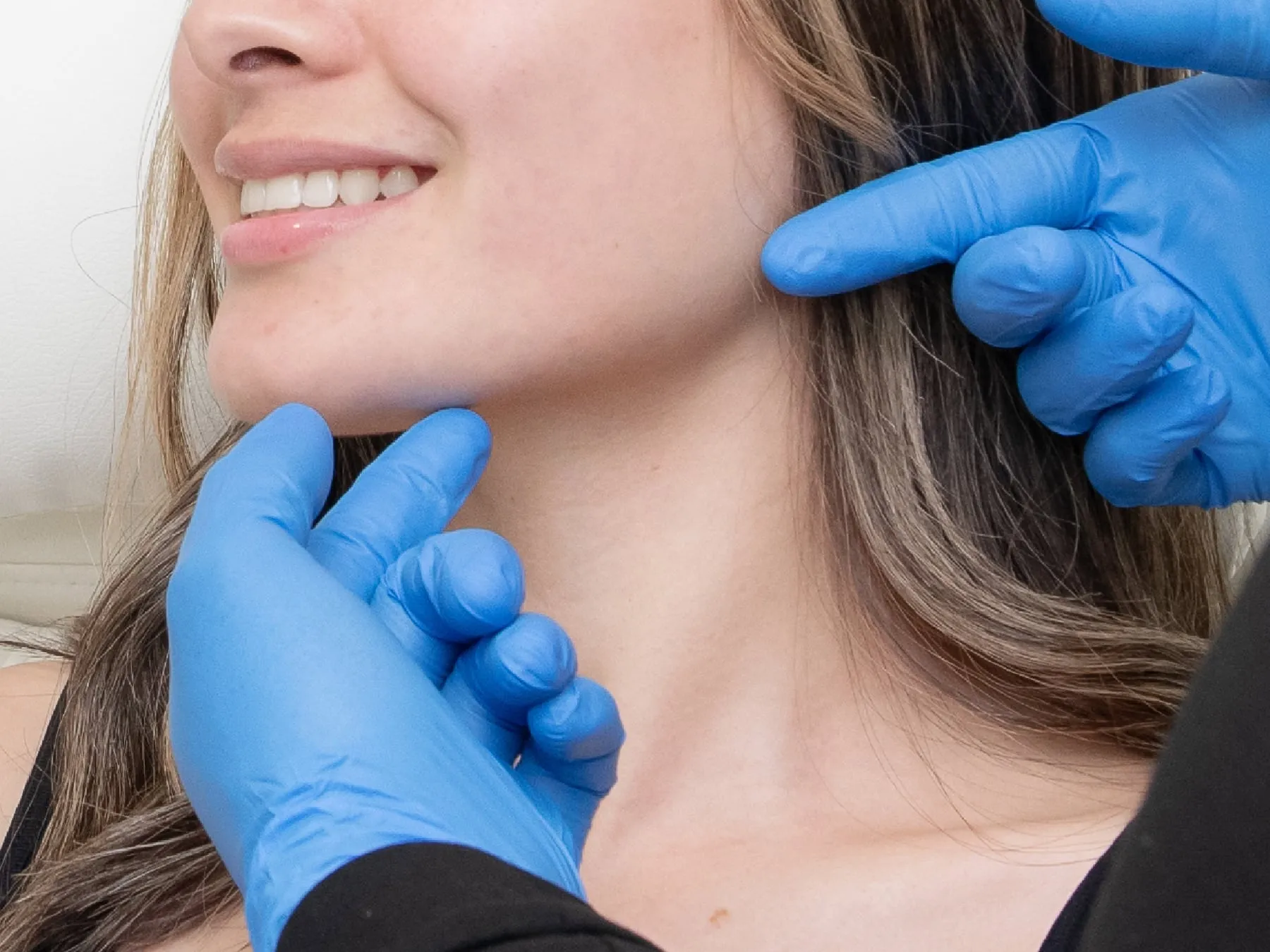Jaw Filler at 360° Aesthetics Tijuana